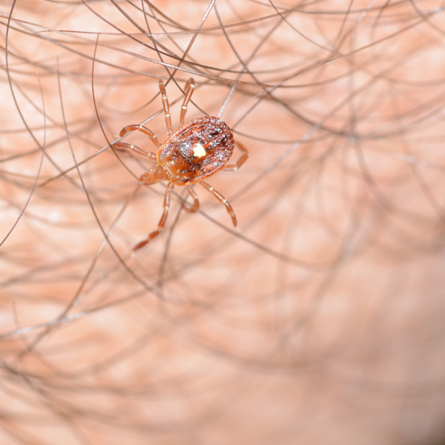 What You Need to Know About Alpha-Gal Syndrome in Northeast Dallas