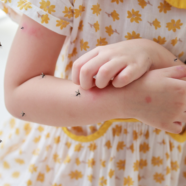 What You Should Know about Mosquitoes in Oconomowoc