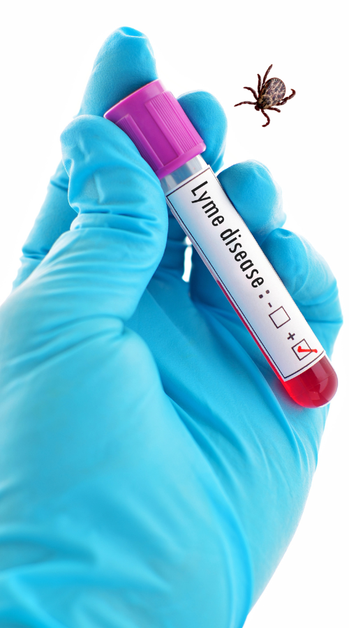 hand holding container that says lyme disease