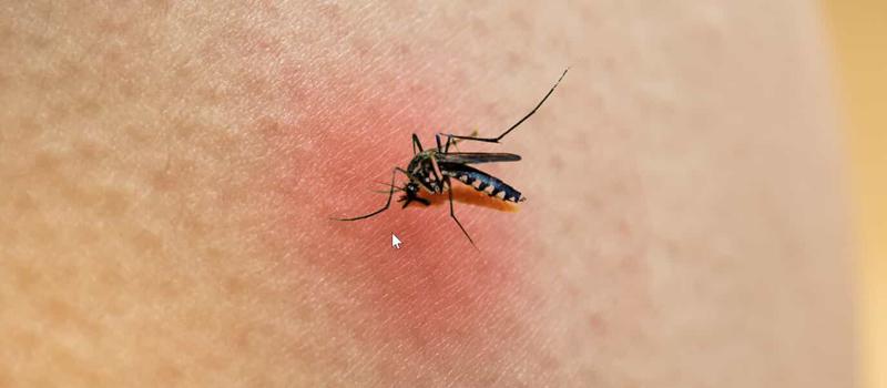 “Skeeter Syndrome” – Yes It’s Real