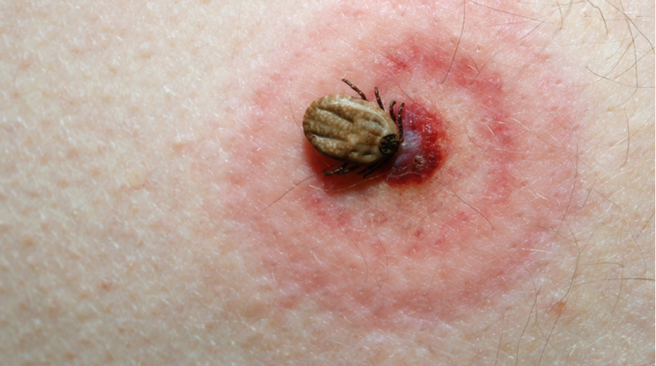 Ways to Avoid Tick Bites