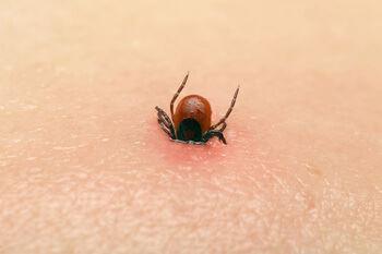 Tick in skin 