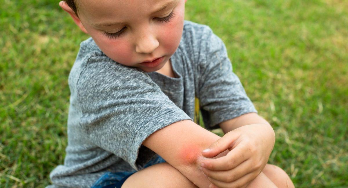 No See Um Control: Why You Need It in Northeast Florida