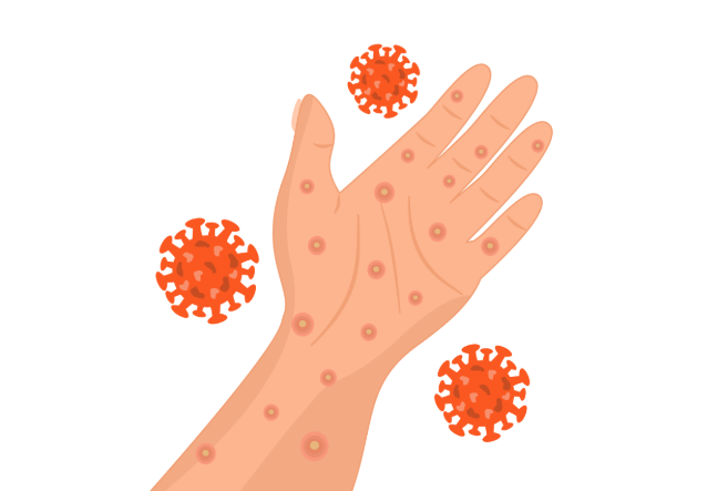 What Are the Risks of Getting Bitten by a Mosquito in South El Monte, CA?