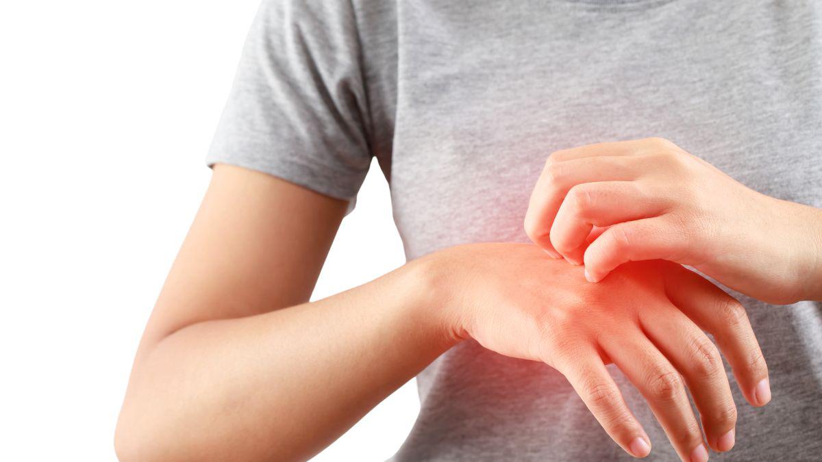 Do you know what a flea bite looks like – or what looks like a flea bite?